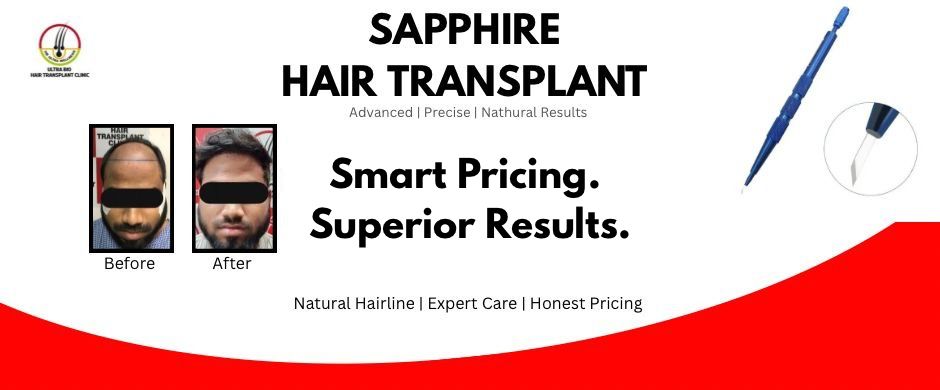 -Diwali special offer hair transpant treatment