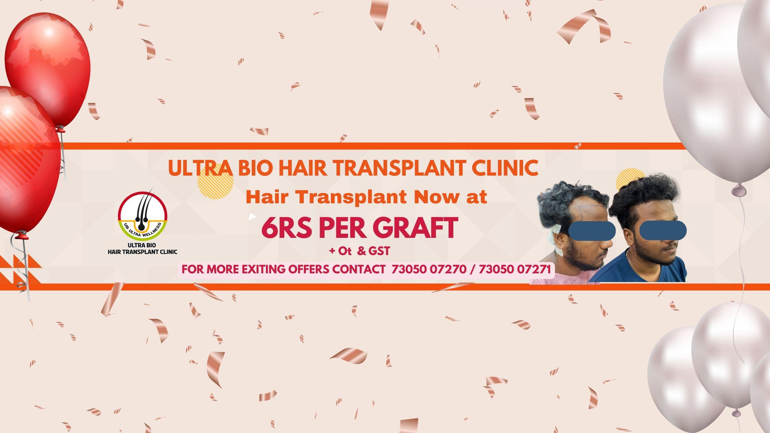 Check with client. Still we need this?
Diwali special offer hair transplant treatment
