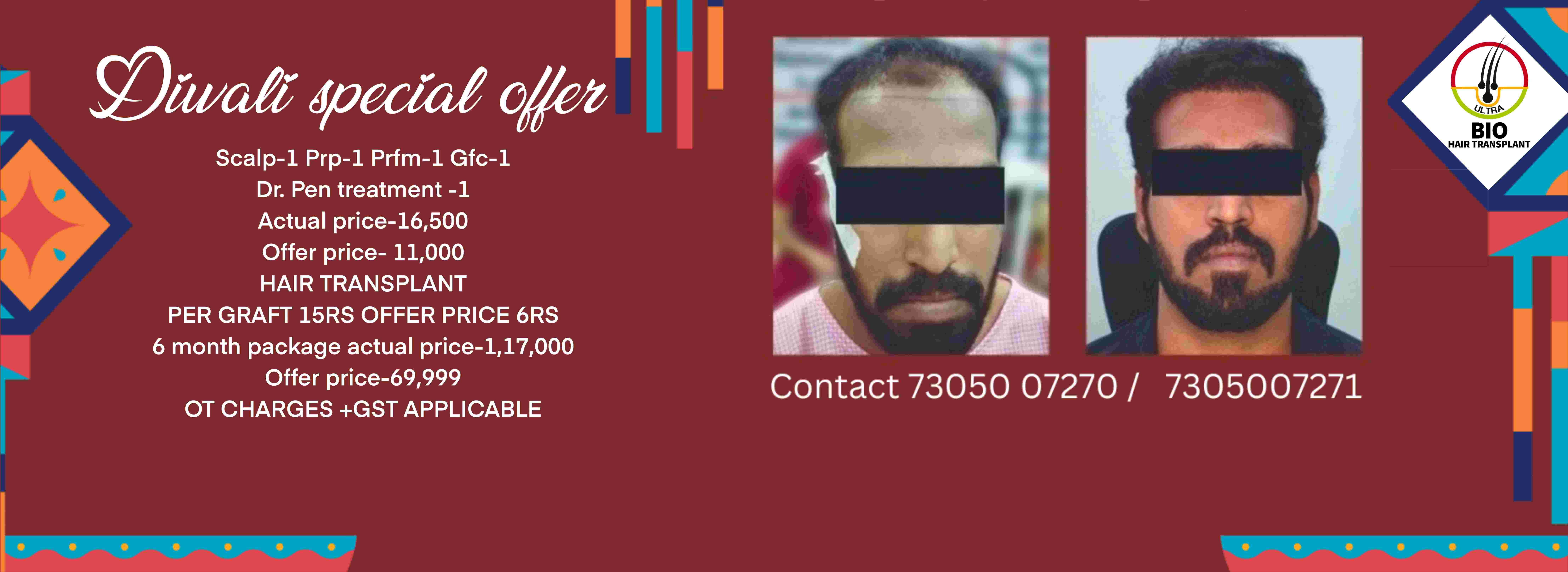 Check with client. Still we need this?
Diwali special offer hair transplant treatment
