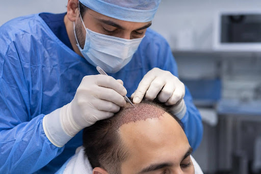 Hybrid Fue Hair Transplant
