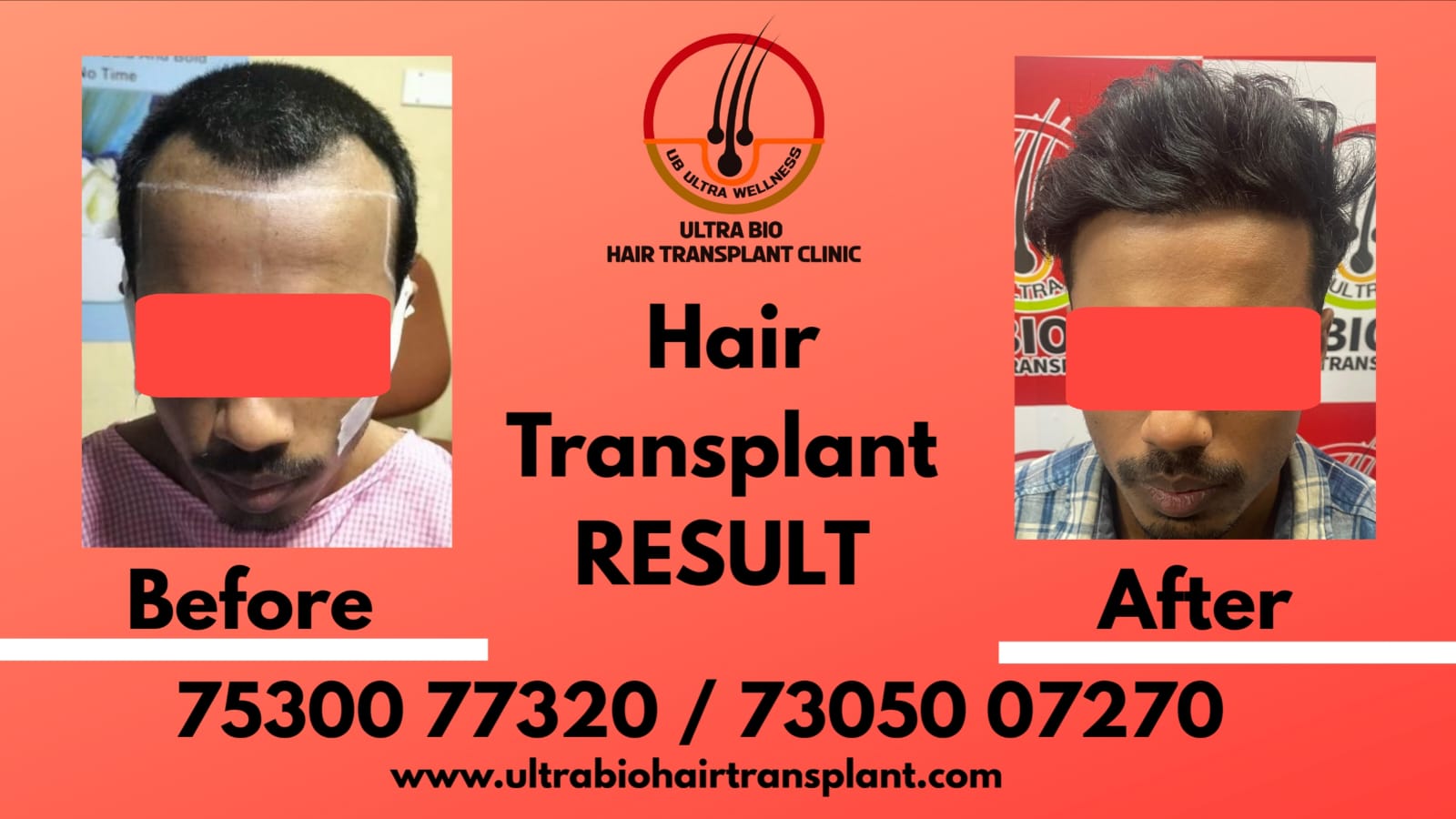 18 month result