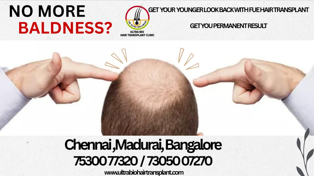 No More Baldness
